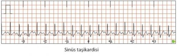 sin__s_ta__ikardisi.jpg